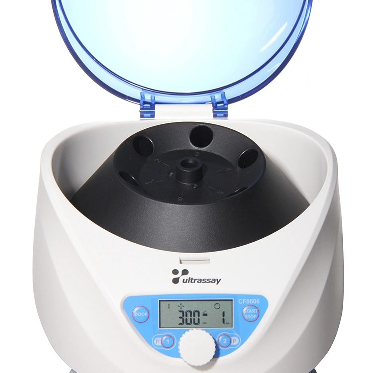 High Quality Prp Centrifuge 300-5000rpm with Rotor Holds up to 15ml/10ml/7ml/5ml X 6 Tubes