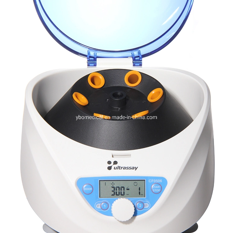 High Quality Prp Centrifuge 300-5000rpm with Rotor Holds up to 15ml/10ml/7ml/5ml X 6 Tubes